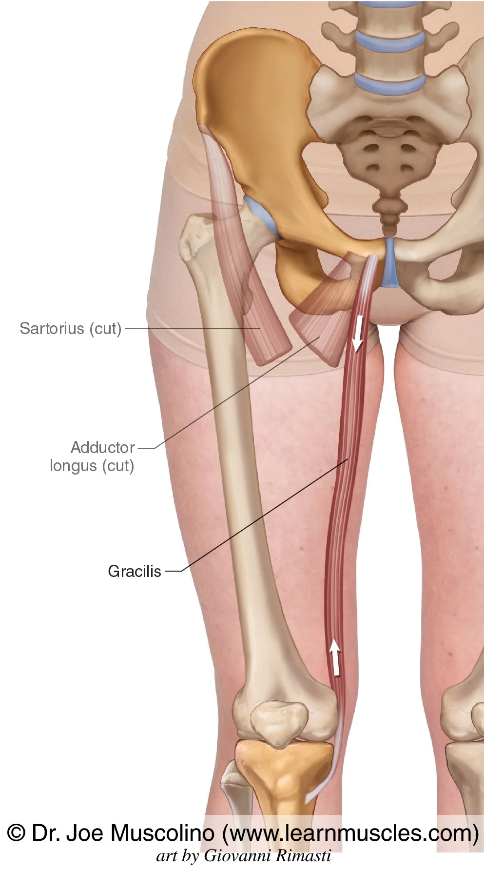 <p>O: Pubis Bone</p><p>I: proximal, medial tibia</p><p>A: adduct and flex thigh</p>