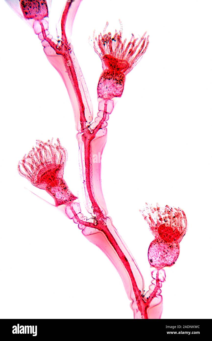 <p>Whats this branch looking figure? </p>