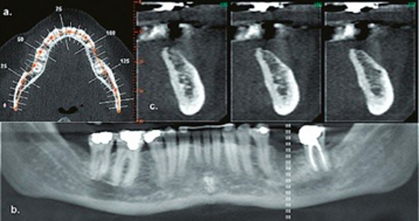 <p>ID the plane of view:</p>