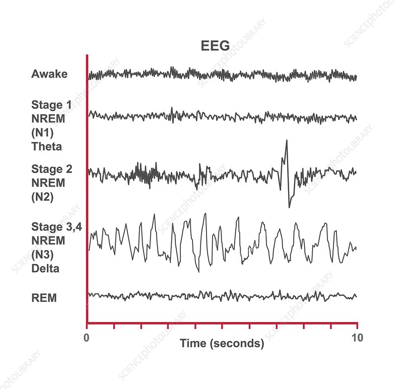<p>theta waves = high amp low freq. — meditation , daydreaming, deep relaxation</p><p>alpha waves = high frew low amp — relaxed wakefulness</p>