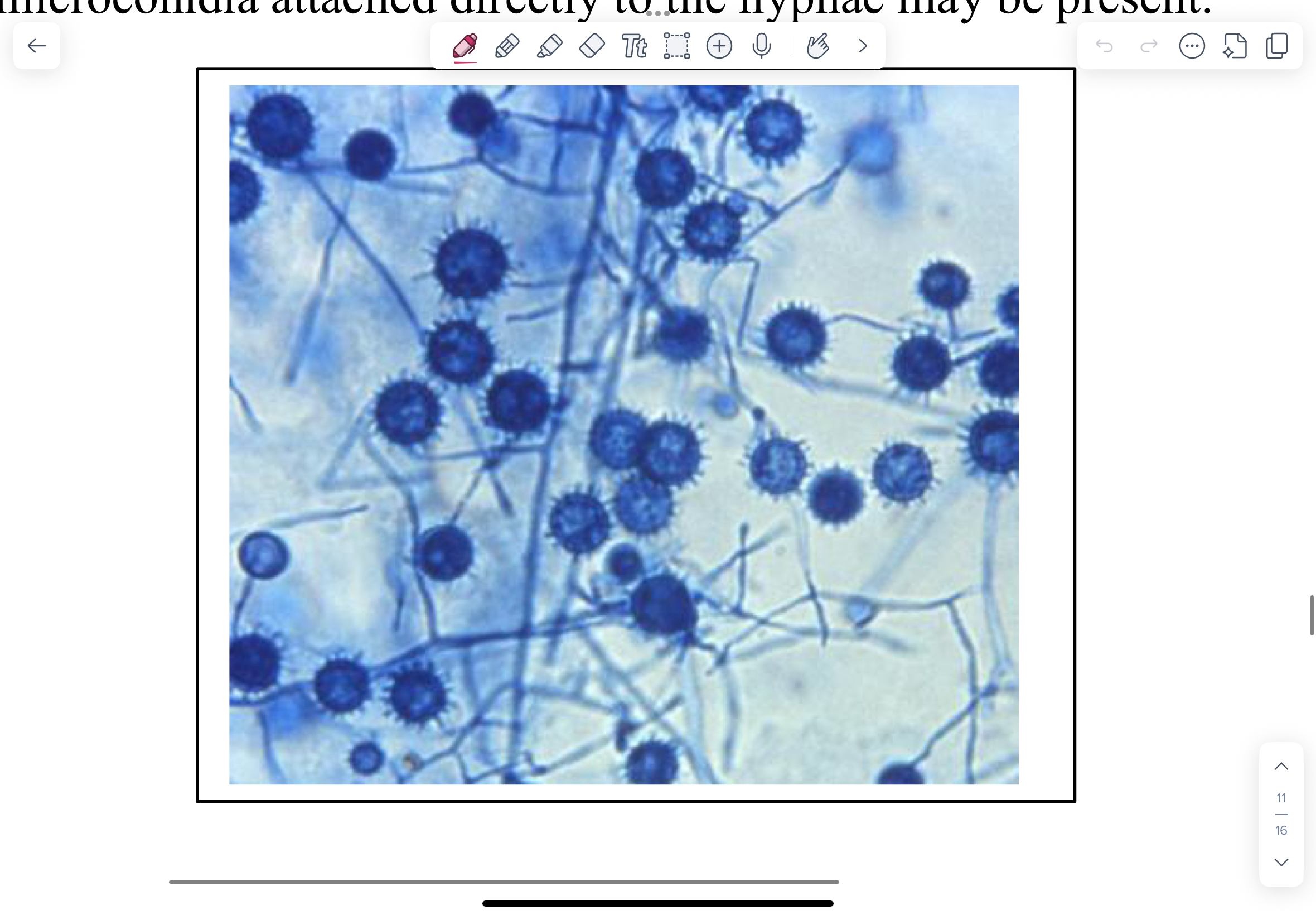 <p>NOTE septate hyphae and characteristic large tuberculate chlamydospores in the culture grown at 20C. Smaller microconidia attached directly to the hyphae may be present.</p>