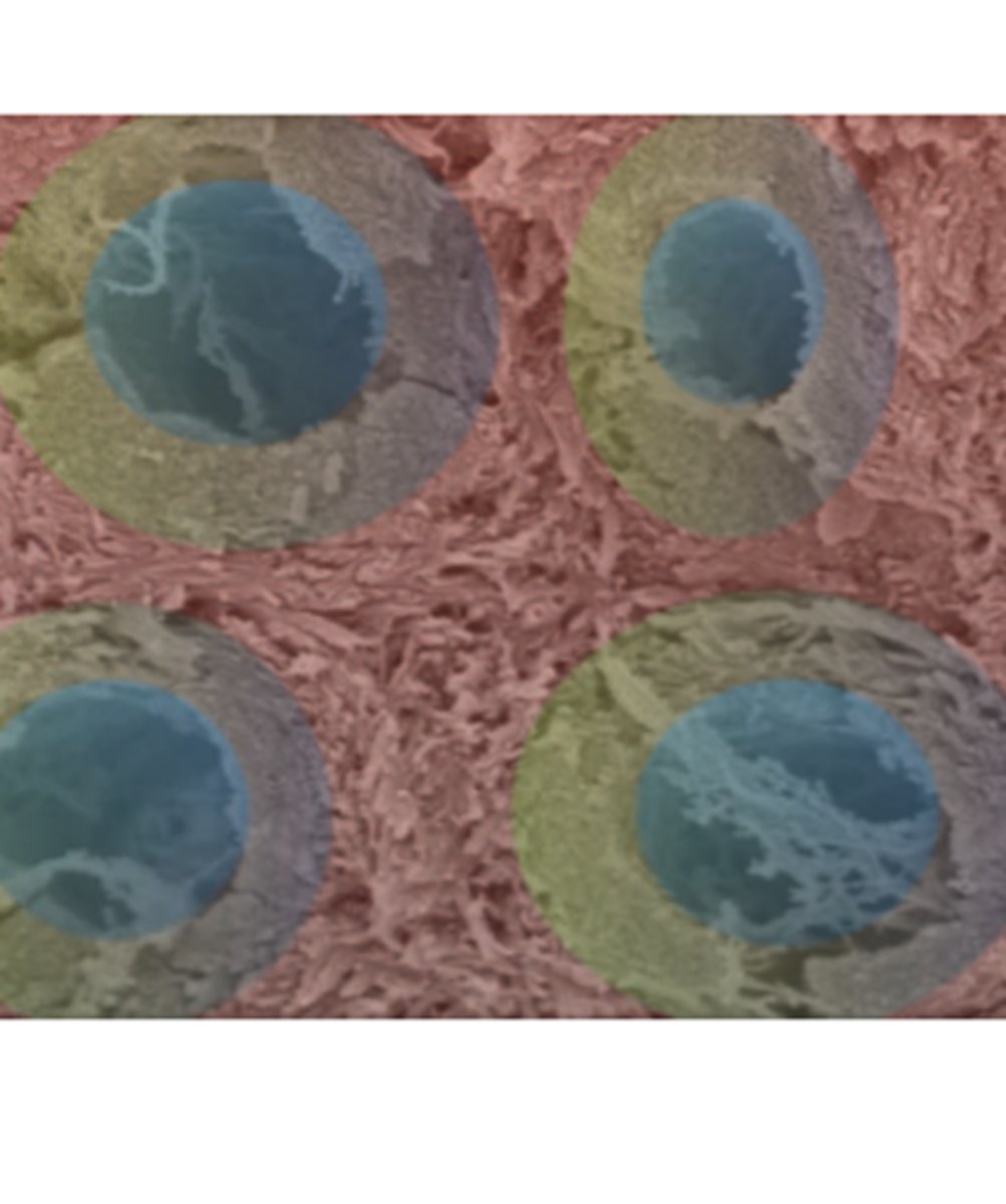 <p>odontoblast cells --> living part of the tooth</p><p>(blue)</p>