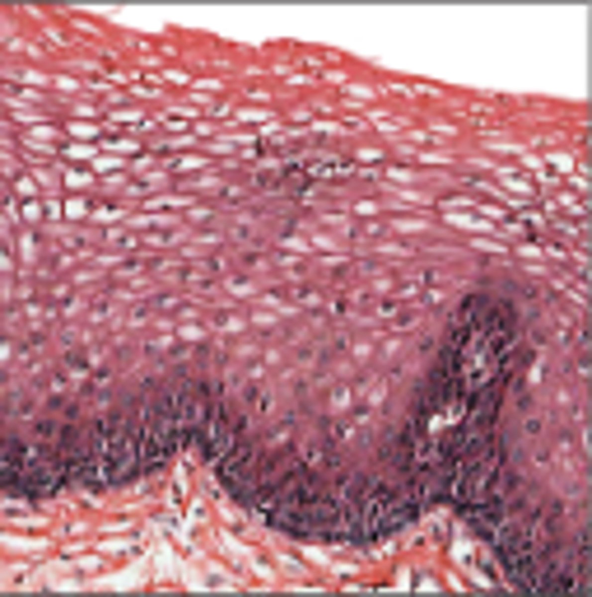<p>Lines oral cavity, part of pharynx, esophagus, vagina, anus</p>
