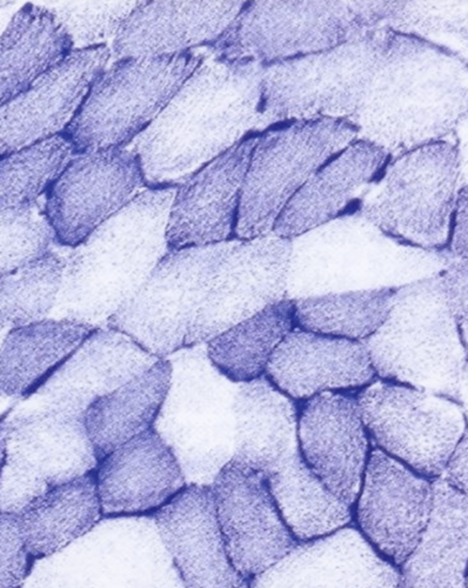 <p>which are aerobic fibers?</p>