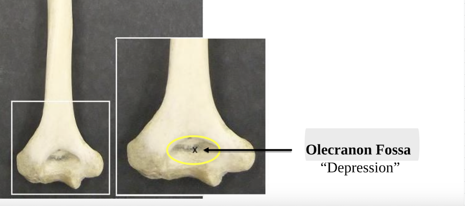 <p>Olecranon Fossa </p>