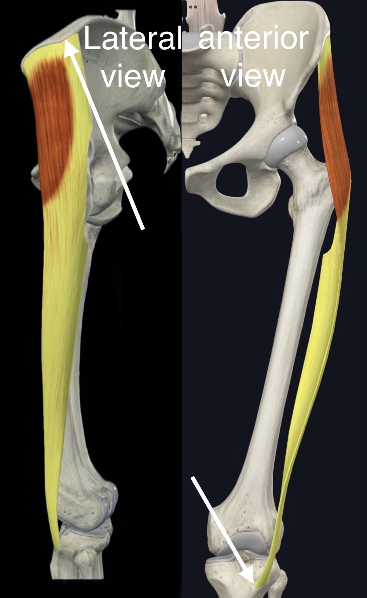 <p>Name the muscle, origin and insertion</p>