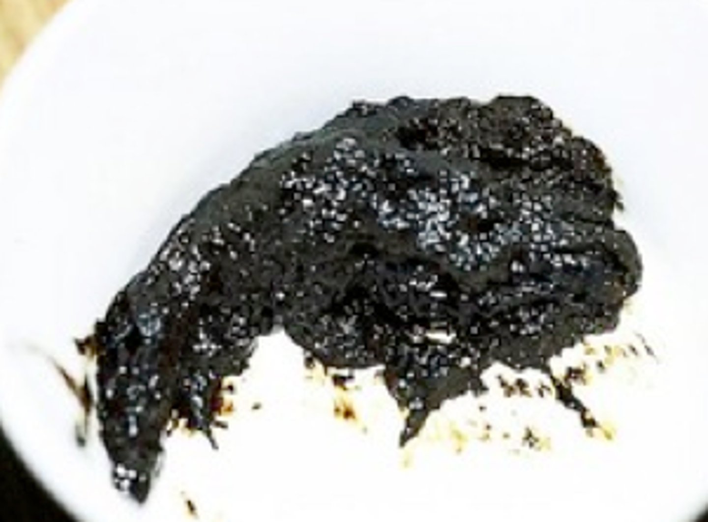 <p>Black, tarry stools.</p>