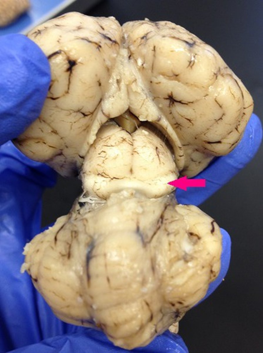 <p>Identify the structure (dorsal view of midbrain).</p>