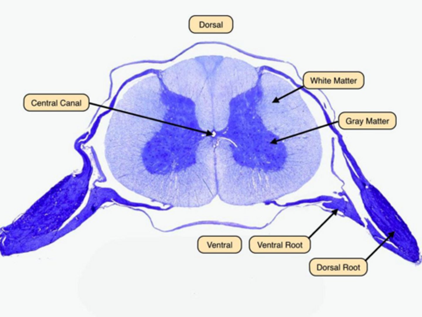 <p>Gray matter contains cell bodies and dendrites, while white matter contains myelinated axons.</p>