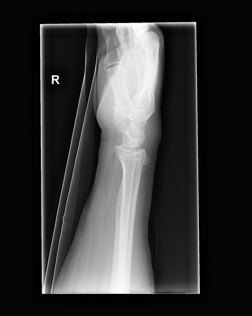 term image