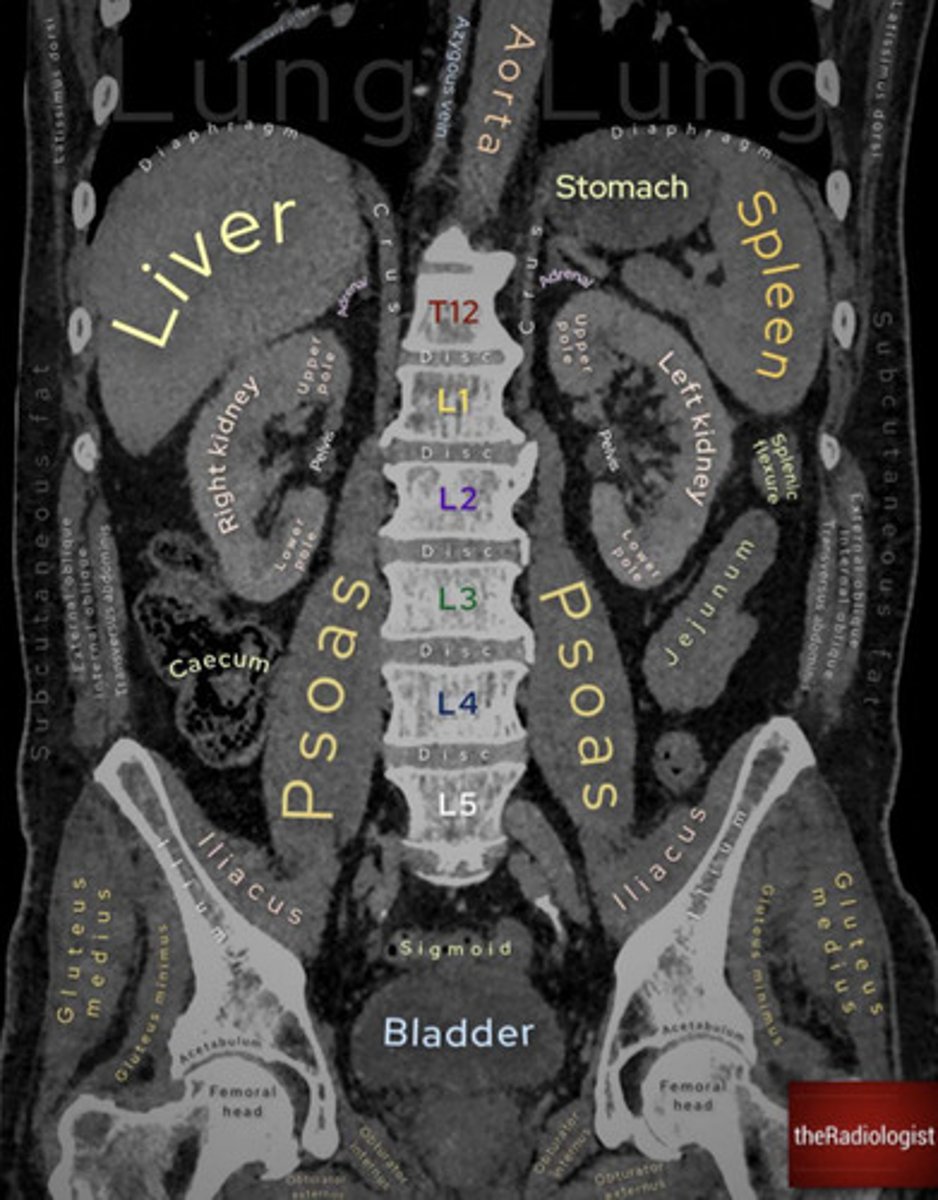 <p>Coronal</p>