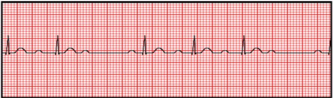 <p>ECG interpretation</p>