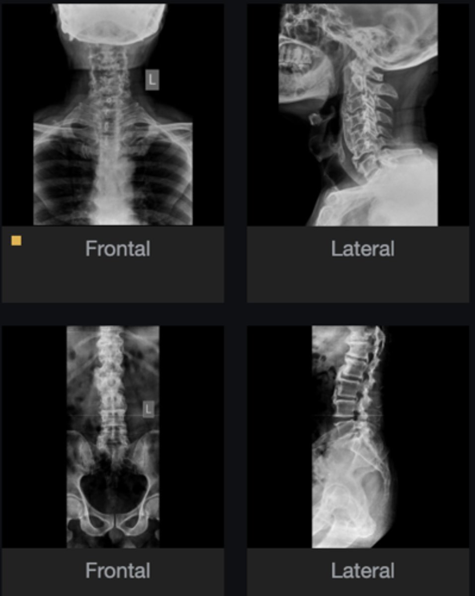 <p>Would you adjust this patient?</p>