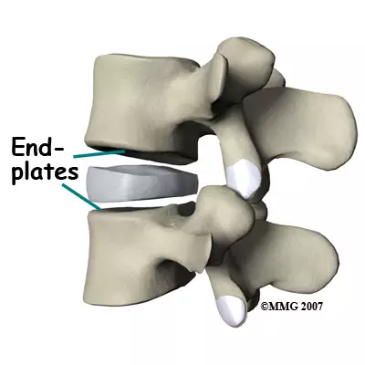 <p>vertebral end-plate</p>