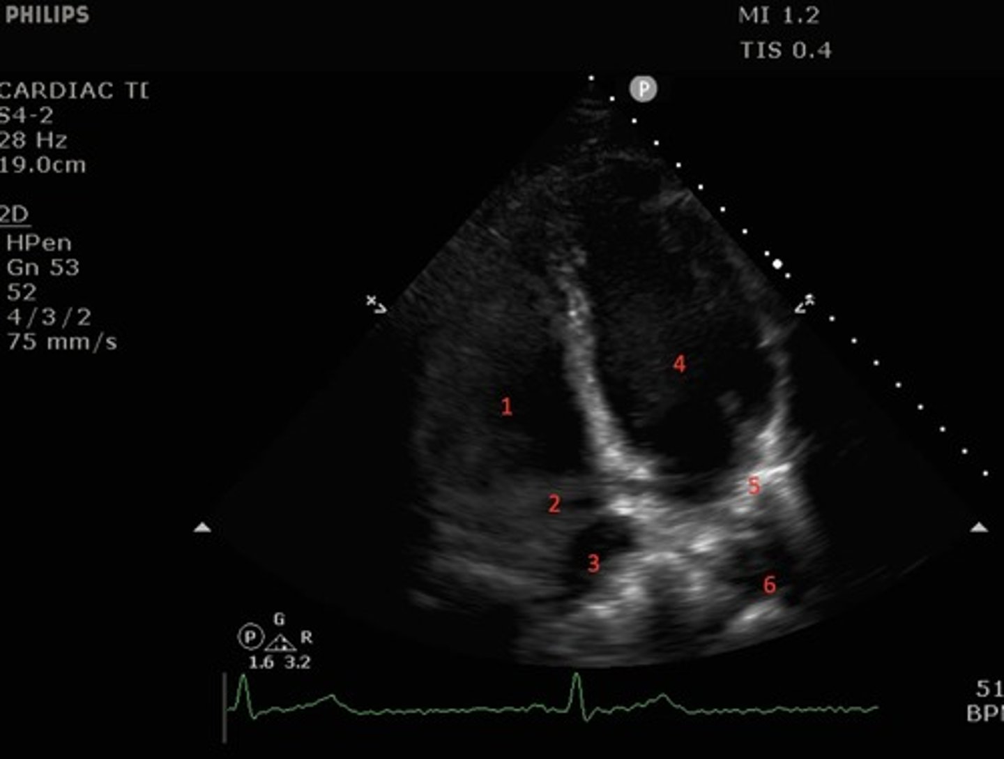 <p>identify the numbered structures</p>