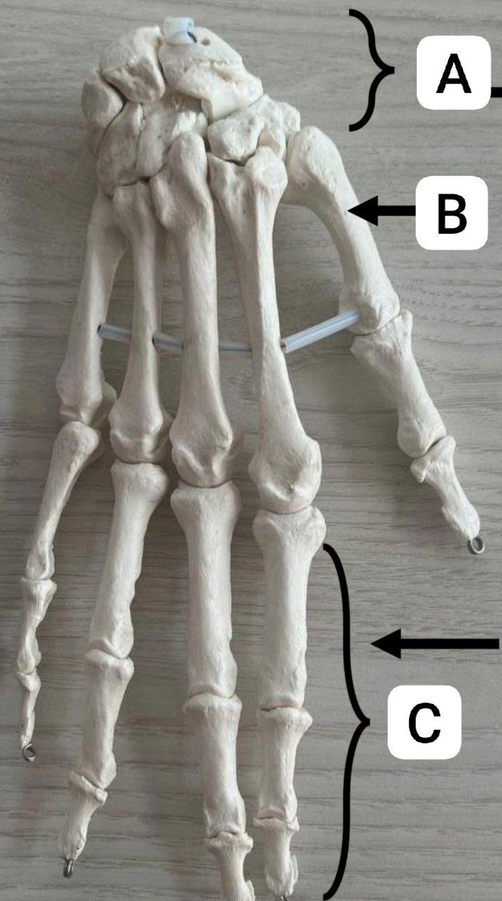 <p>Identify the following and classify according to position and shape</p>