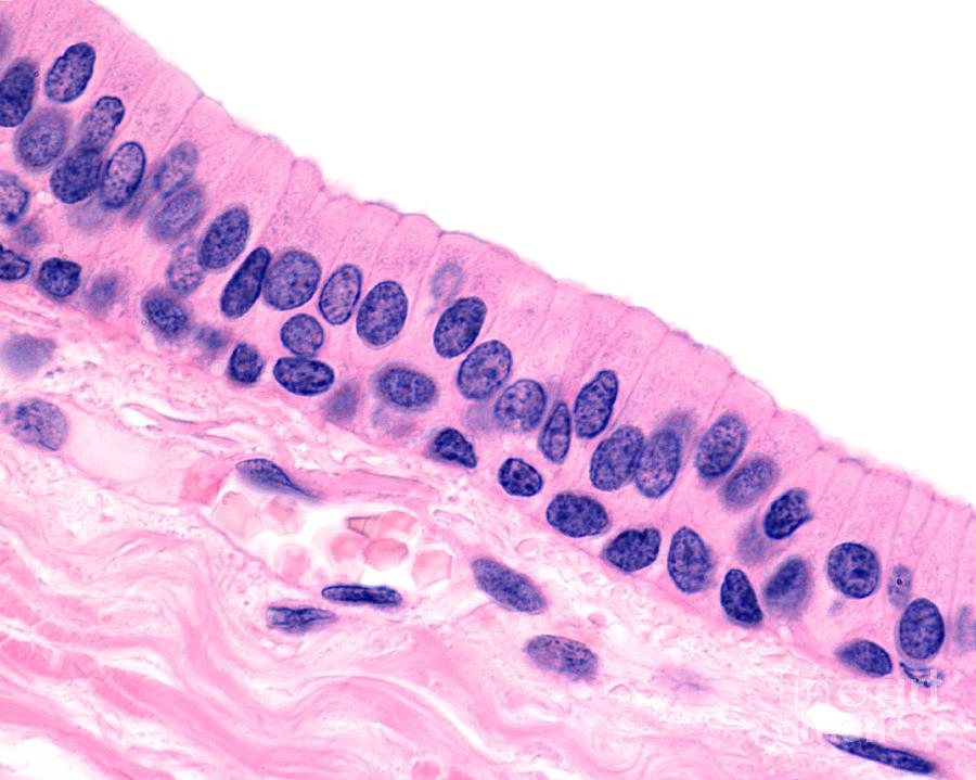 <p>Epithelial tissue: stratified Columnar</p>
