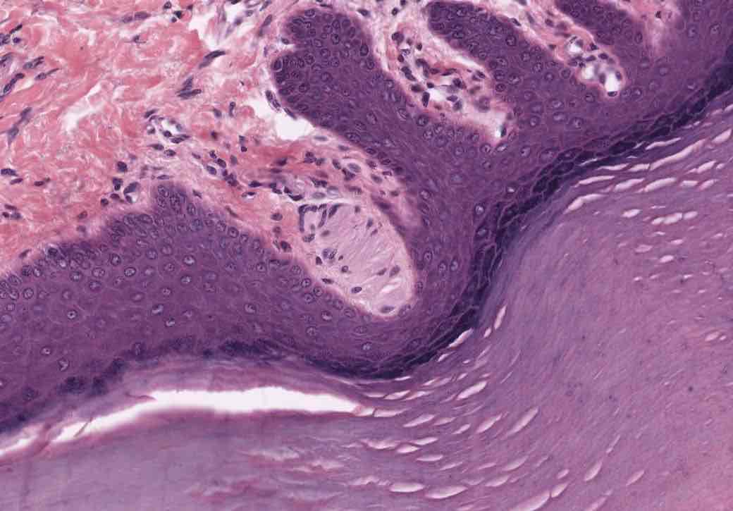 <p>Can you identify this sensory receptor? where it’s found and what is it’s function?</p>
