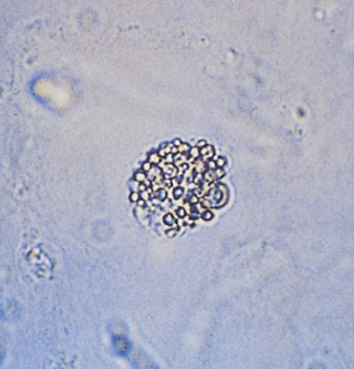 <p>HPF</p>