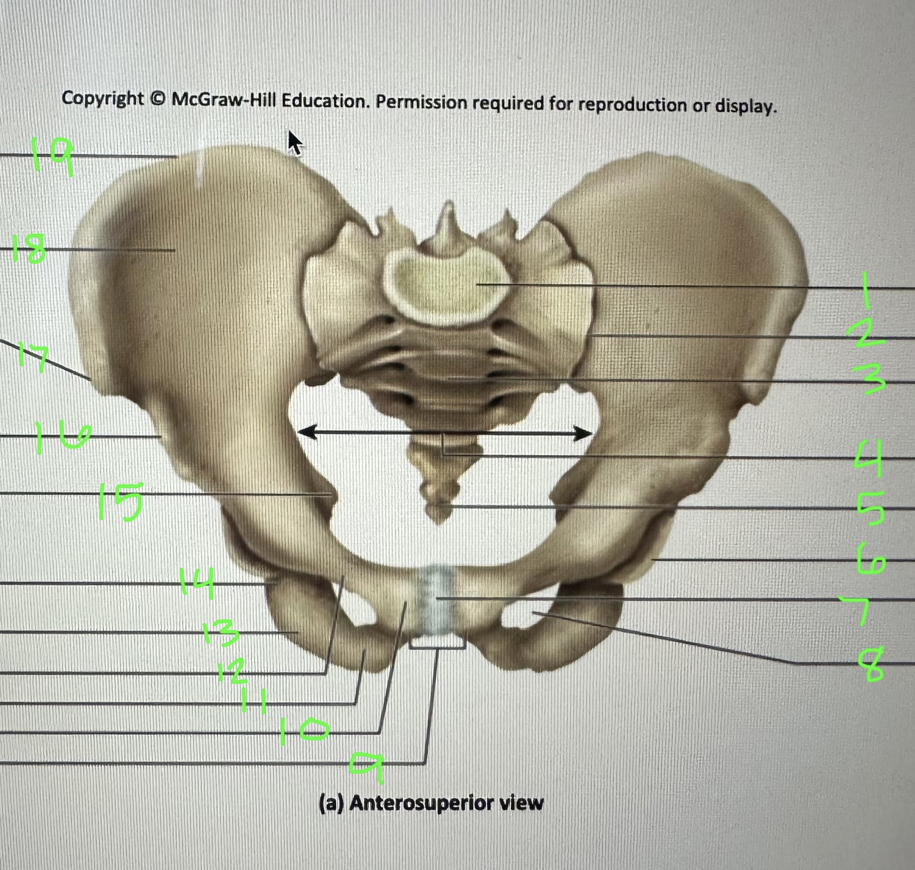 <p>interpubic disc</p>
