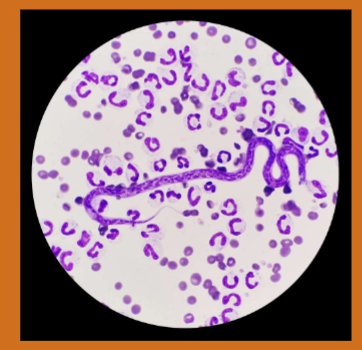 <p><span><span>Dirofilaria immitis</span></span></p>