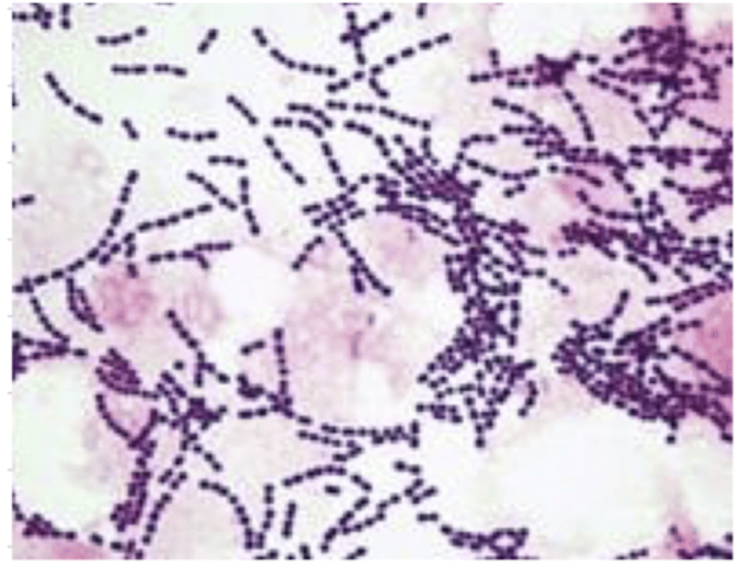 <p>which bacteria?</p>