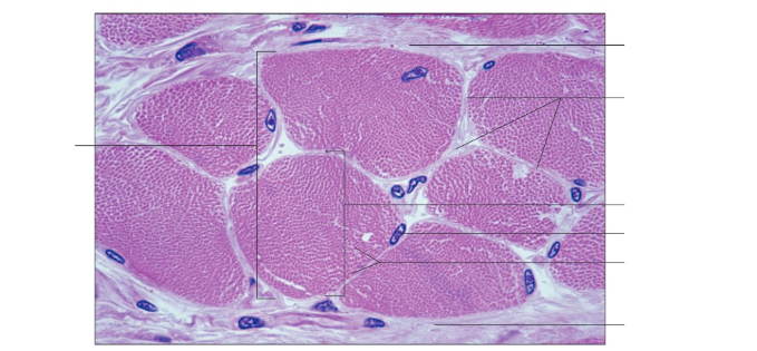 <p>Label the following: Fascicle under a microscope&nbsp;</p>