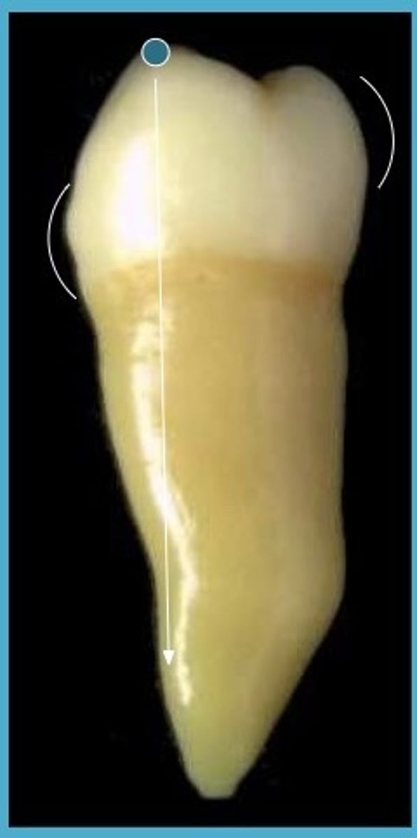 <p>less lingual crown tilt</p>