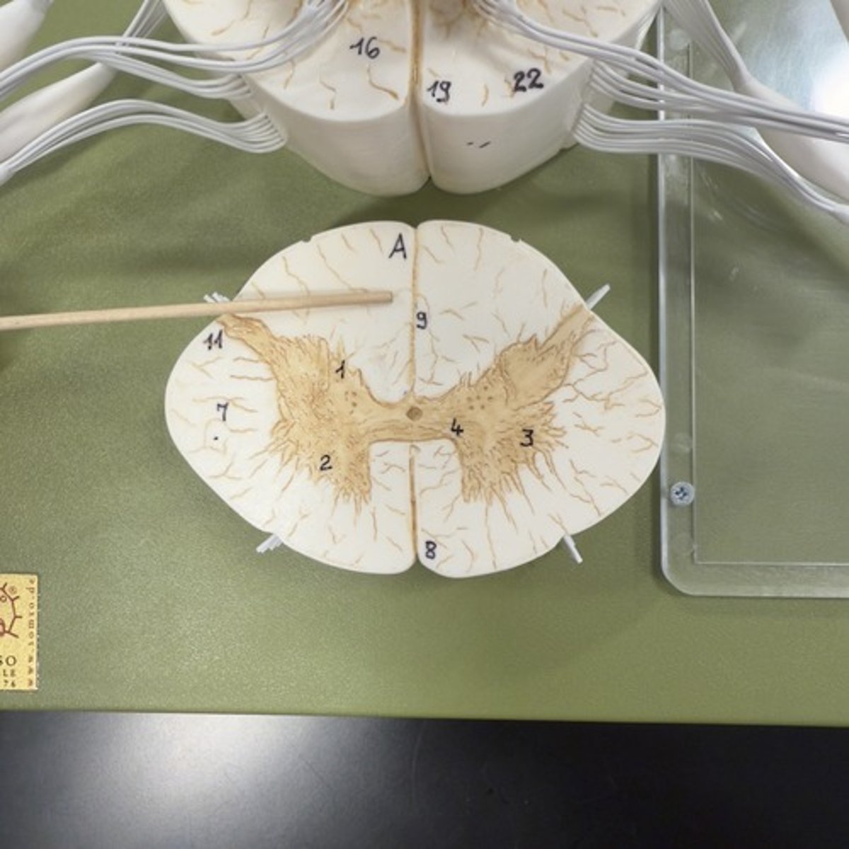 <p>Identify the structure.</p>