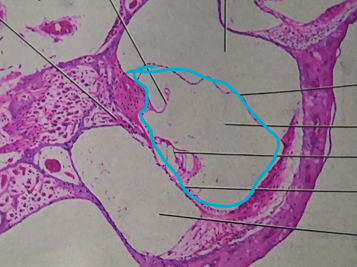 This structure is FILLED with