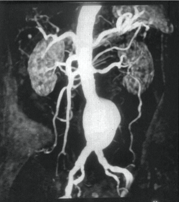 <p>What does this angiogram refer to</p>