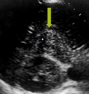 <p>What is this yellow arrow pointing to?</p>