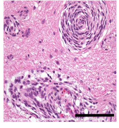 <p>What connective tissue cell is shown in the following image?</p>