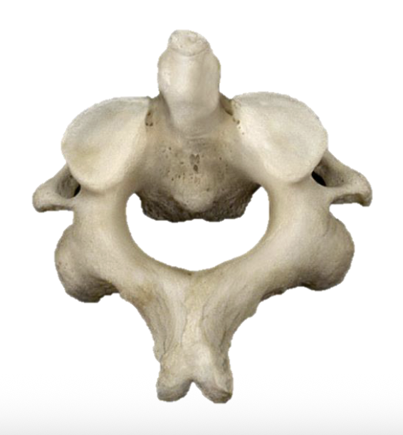 <p>What Is This Bone’s Name?</p>