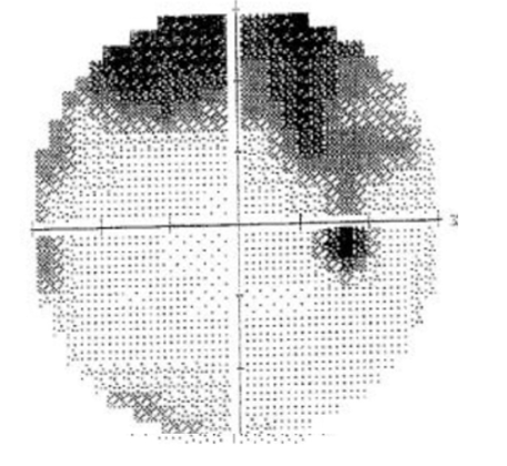 <p>what kind of defect is this? </p>
