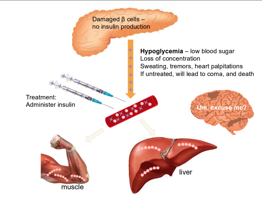 <p>Hypoglycaemia</p>