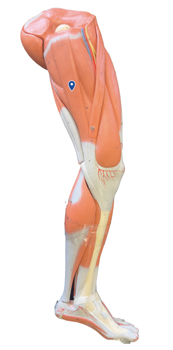 <p>What muscle is the arrow pointing to?</p>