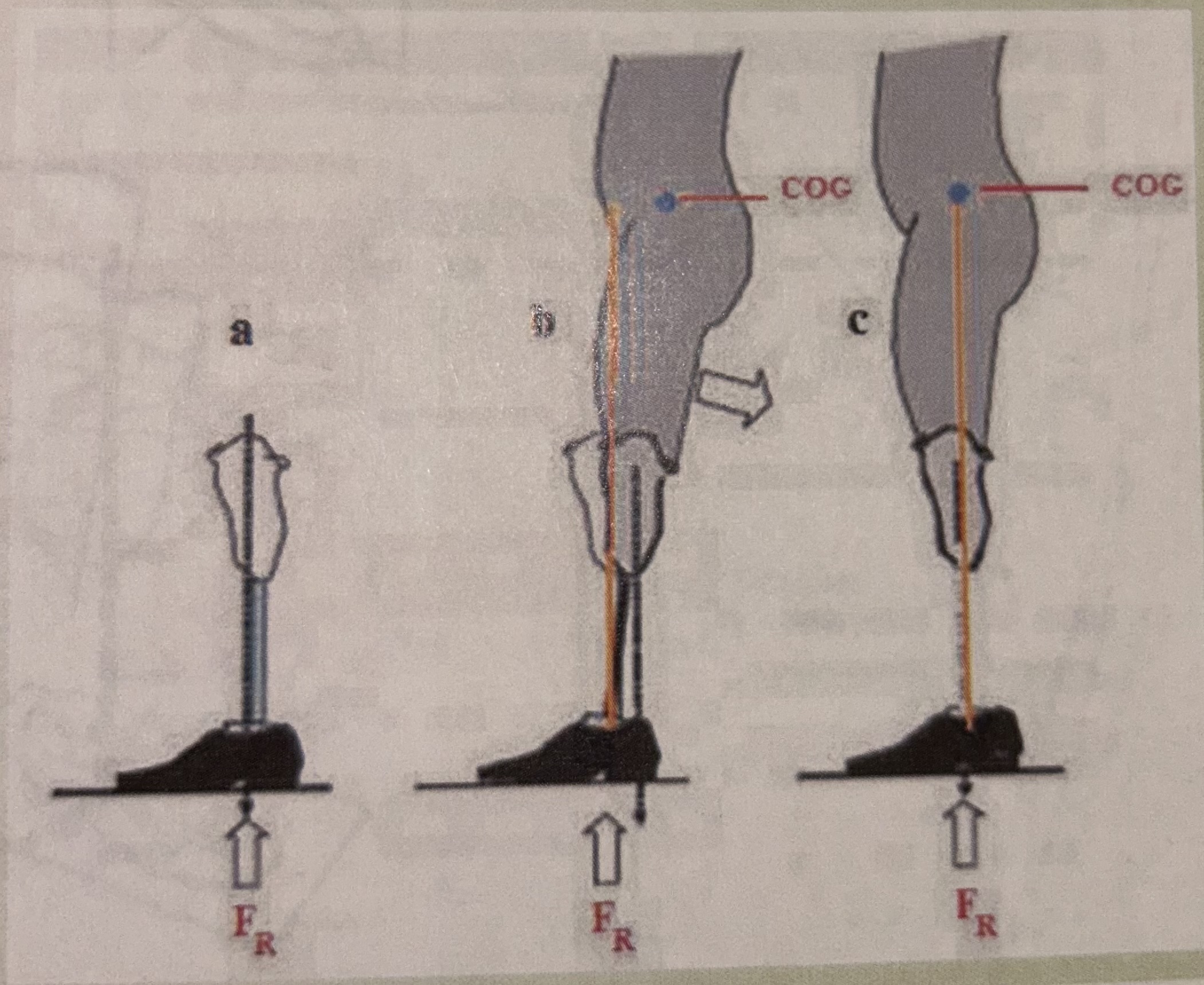 <p>a: align the vertical axis of the limb - body weight should fall on the center of prosthetic ankle</p><p>b: unbalanced position</p><p>c: ideal/correct alignment</p>