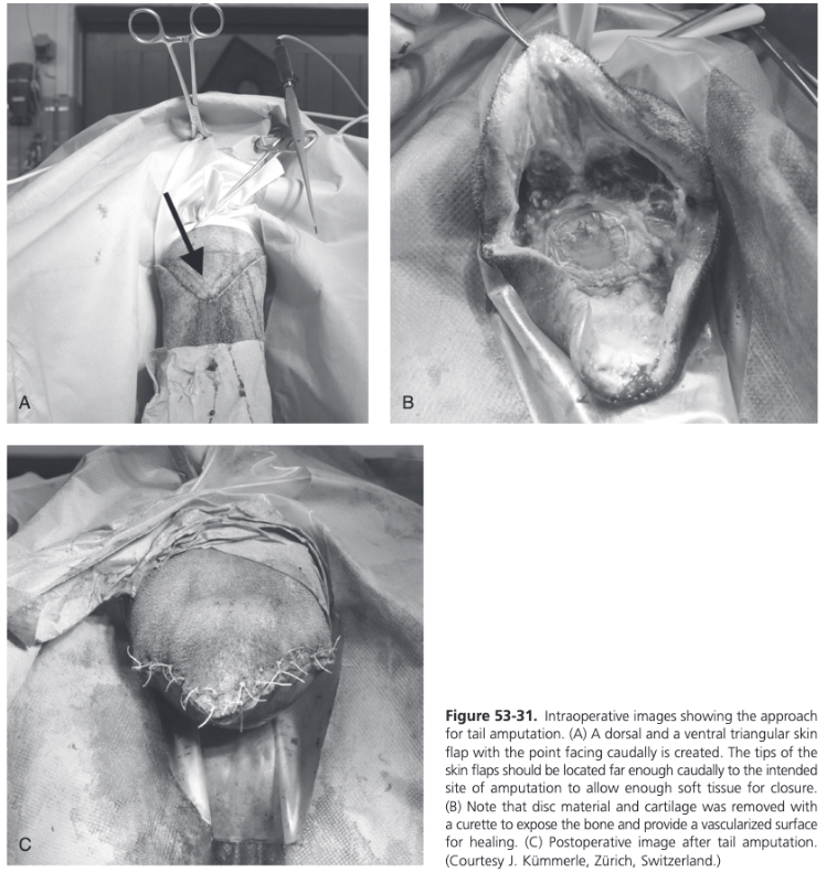 <ul><li><p><span>In selected cases, amputation of the tail distal to the injury is necessary</span></p><ul><li><p><span>Penrose drain or Esmarch bandage placed tightly around the most cranial aspect of the tail</span></p></li><li><p><span>Two flaps created from the dorsal and ventral ends of the skin</span></p><ul><li><p><span>Points of these flaps are facing caudally and should be located caudal to the site of amputation to allow enough soft tissue for wound closure</span></p></li></ul></li><li><p><span>Scalpel used to transect between two coccygeal vertebrae at the site of the amputation</span></p></li><li><p><span>Disc material and cartilage removed with a curette to expose a vascularized bony surface that supports healing</span></p></li><li><p><span>Subcutaneous tissues and skin closed routinely</span></p></li><li><p><span>Stent bandage applied and covered with an adhesive barrier drape</span></p></li></ul></li></ul>