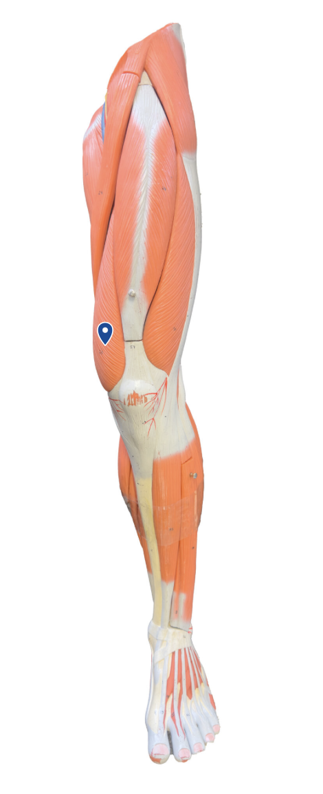 <p>What muscle is the arrow pointing to?</p>