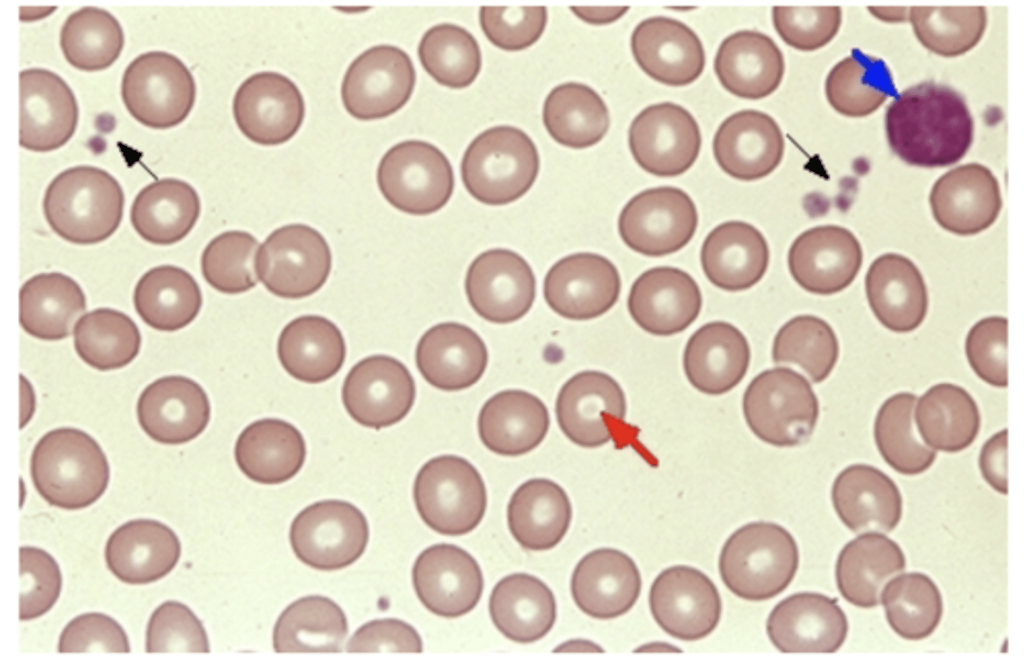 knowt flashcard image