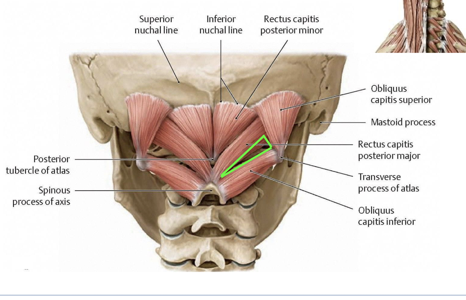 <p>help to resist the pull of gravity on the head</p><p></p><p>the <strong>capitis</strong> muscles form the subboccipital triangle.</p><p></p><p>Vertebral Artery, Sub-Occipital Nerve, Posterior arch of atlas</p><p></p><p>C2 nerve innervates the skin over this triangle</p>
