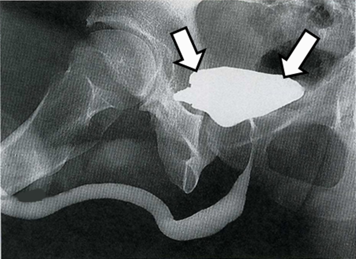 <p>What is indicated in the image?</p>