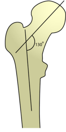 <p>120-135 degree</p>