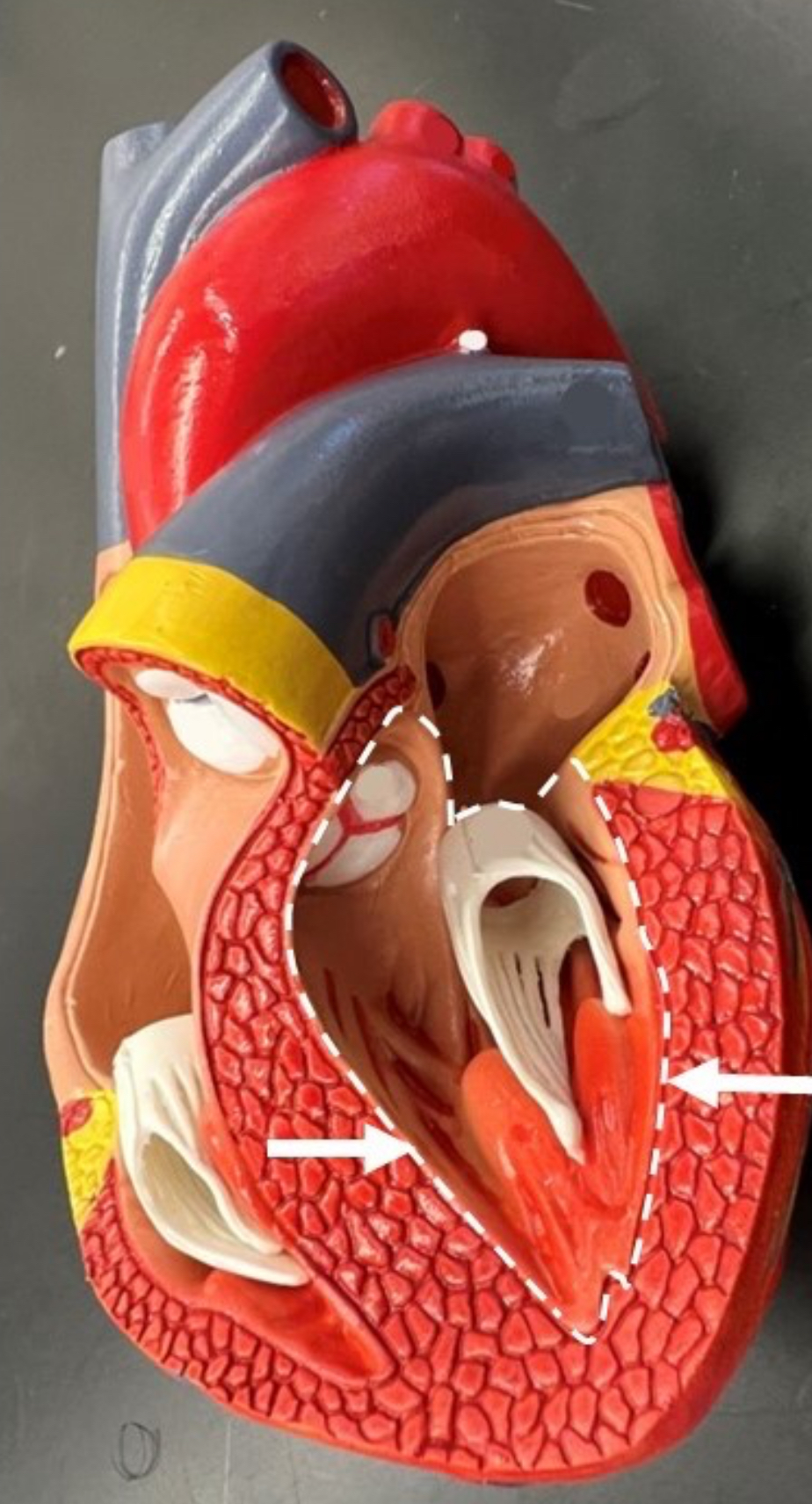 term image