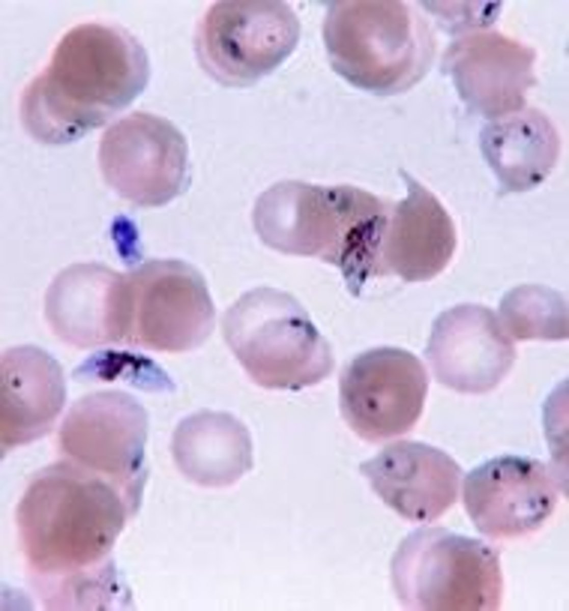 <p>Involves mosquitoes and Plasmodium parasites.</p>