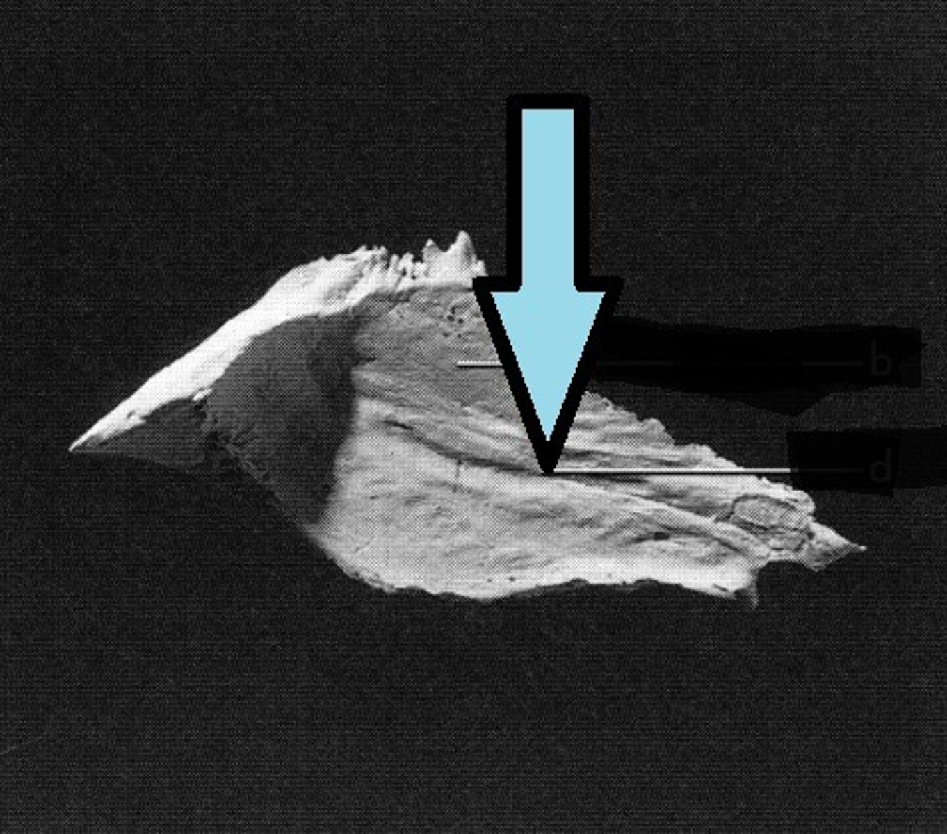 <p>what feature of vomer is this?</p>