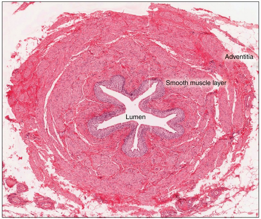 <p>the duct by which urine basses from the kidney to the bladder</p>