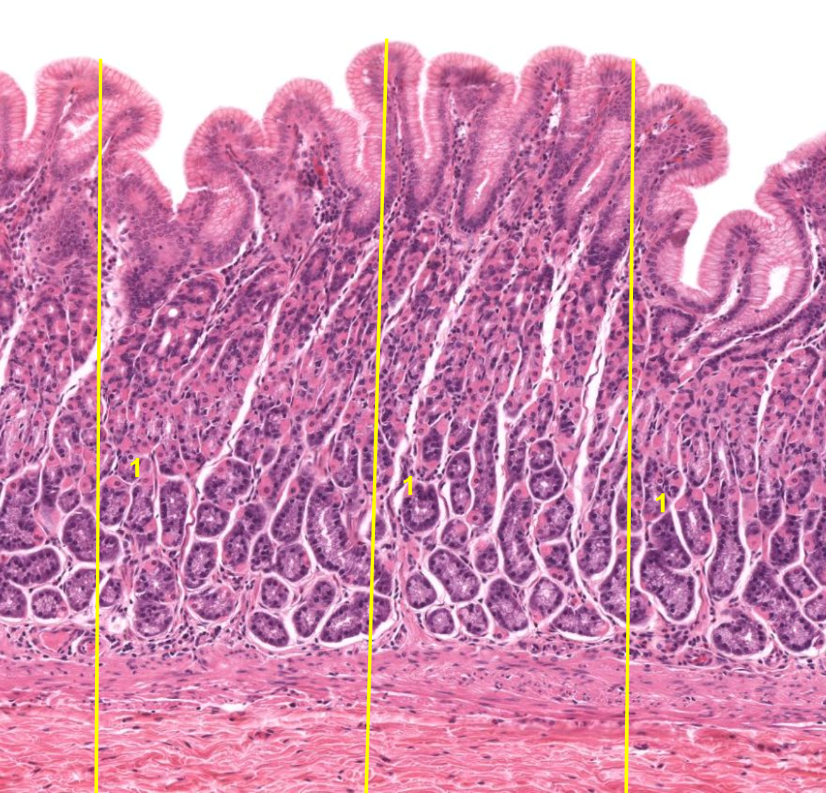 term image