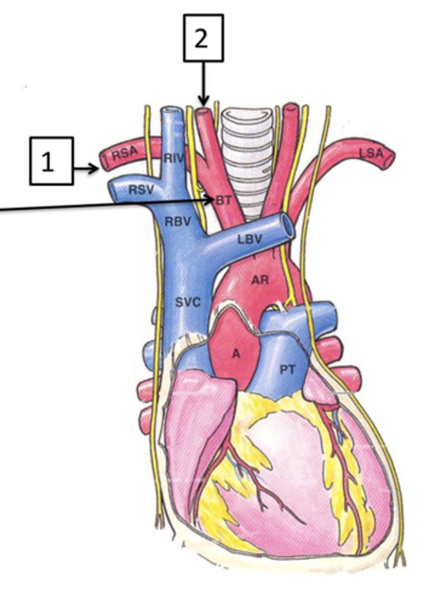 <p>The first main branch off the aortic arch is what?</p>